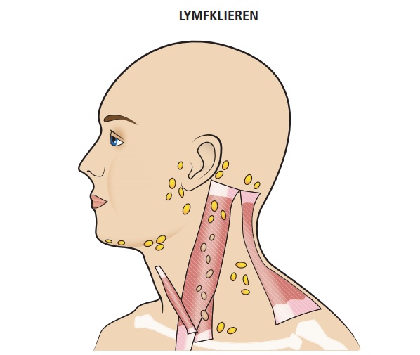 Symptomen Lymfeklier Hals Symptomen 2020