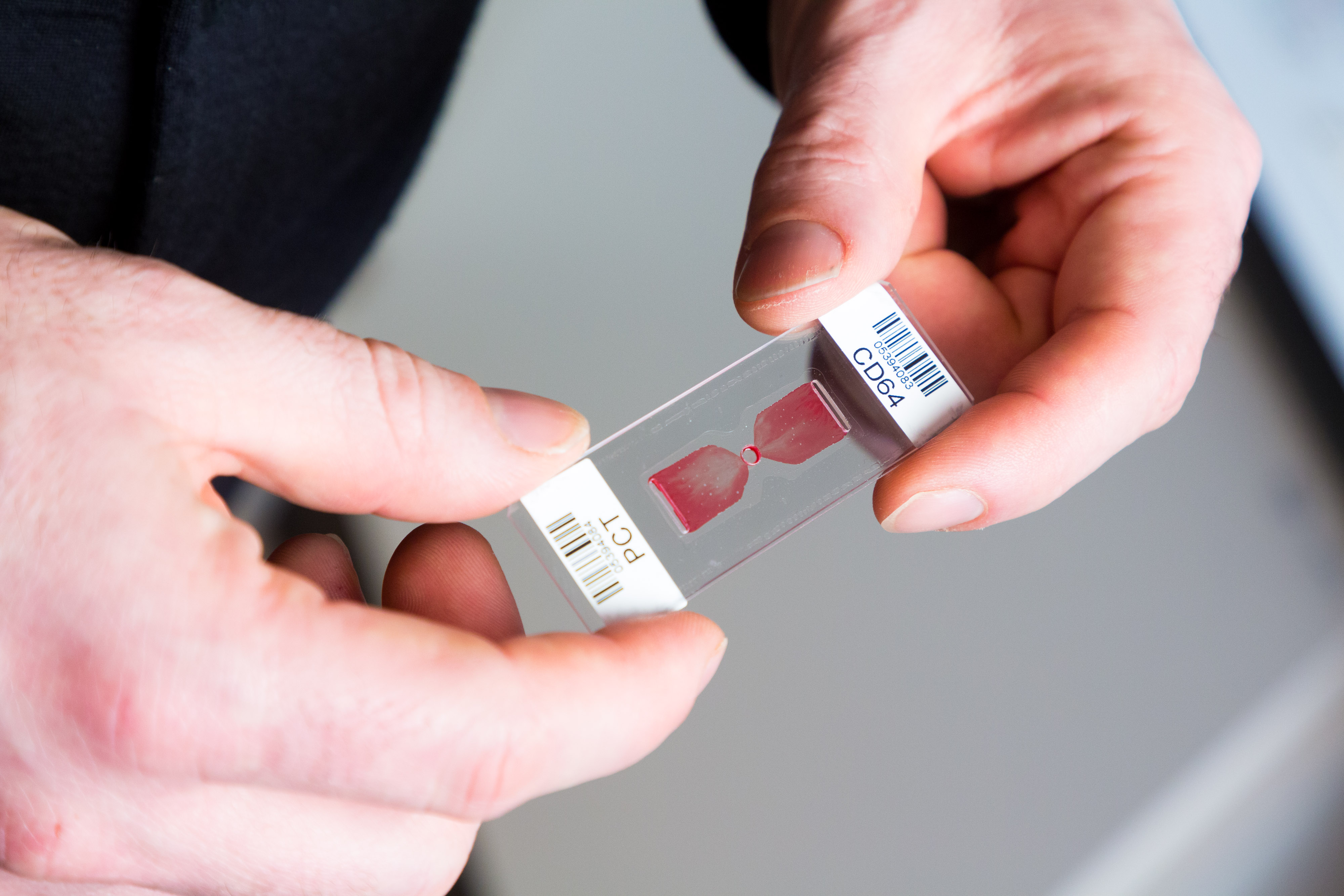 Lab-on-a-chip